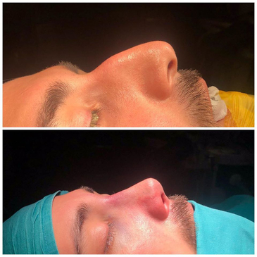 Slider image (2) Istanbulesthe Clinic